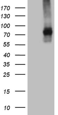 TGFBR2 Antibody (aa23-294, clone OTI3B4)