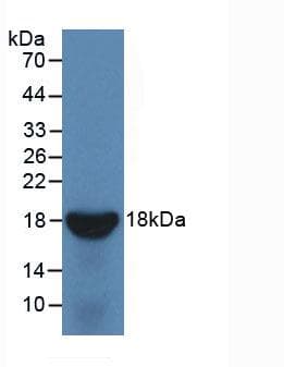 Human IL10RB Protein (Recombinant His, N-Terminal)
