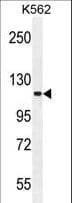 SKOR2 Antibody (aa870-898)