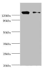 DIS / CCAR1 Antibody (aa1-200)