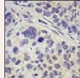 Polyclonal Rabbit anti-Human USP8 / UBPY Antibody (aa1058-1087, IHC, WB)