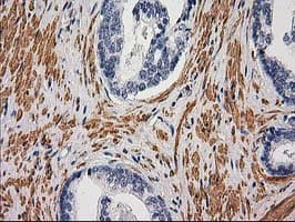 DES / Desmin Antibody (aa104-391, clone 4G1, Carrier-free)
