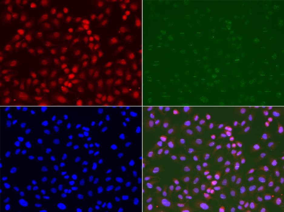 Polyclonal Rabbit anti-Human RAD9A / RAD9 Antibody (IHC, IF, WB)