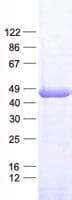 Human RAD51B Protein (Recombinant His, N-Terminal)