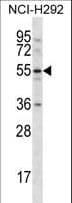 CLEC18A Antibody (aa338-367)