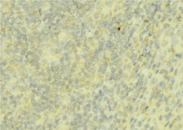 Polyclonal Rabbit anti-Human HAMP / Hepcidin Antibody (IHC, WB)