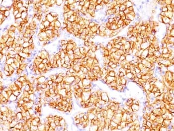 CA9 / Carbonic Anhydrase IX Antibody (clone PN-15, Ready-to-Use)