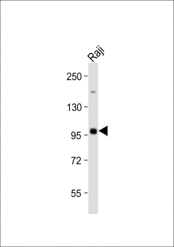 Polyclonal Rabbit anti-Human MAP4K1 / HPK1 Antibody (WB)