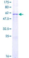 Human AZGP1 / ZAG Protein (Recombinant GST)