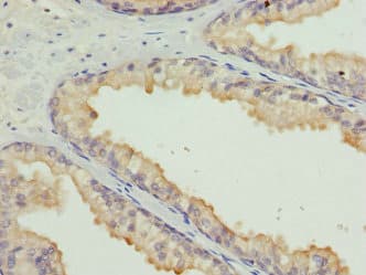 Polyclonal Rabbit anti-Human HMG1 / HMGB1 Antibody (IHC, WB)
