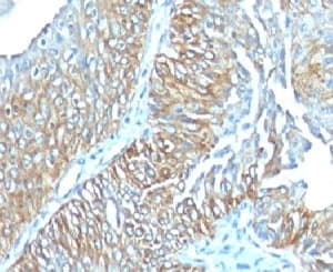 Monoclonal Mouse anti-Human TRIM29 Antibody (clone TRIM29/1041, aa1-200, IHC, IF)