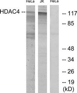 HDAC4 Antibody (p632)