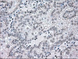 BRAF / B-Raf Antibody (clone OTI1G8)