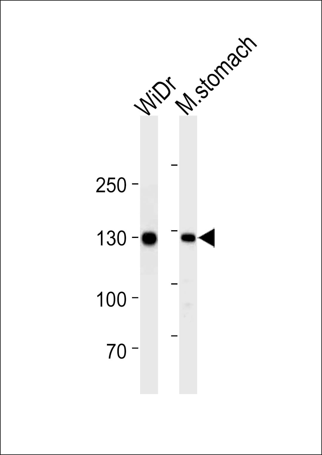 PathPlus™ CDH1 / E Cadherin Antibody (clone 813CT11.1.3)