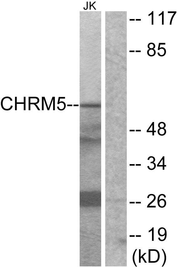CHRM5 / M5 Antibody