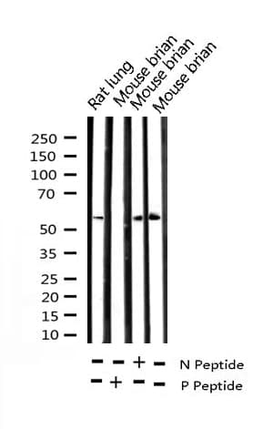 CHEK2 / CHK2 Antibody (phospho-Thr68)