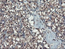 SERPINB1 Antibody (clone OTI4B3)