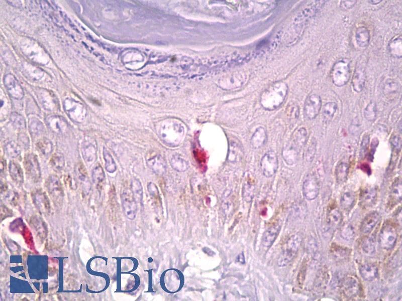 IHC-plus™ Polyclonal Rabbit anti-Human PLCG1 Antibody (aa751-800, IHC, WB)