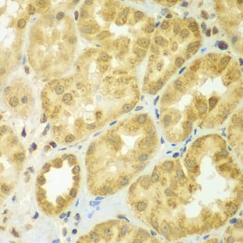 ADCK3 / CABC1 Antibody