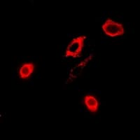 IHC-plus™ Polyclonal Rabbit anti-Human GPX4 / MCSP Antibody (IHC, IF, WB)