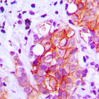 GAD1 + GAD2 Antibody (C-Terminus)