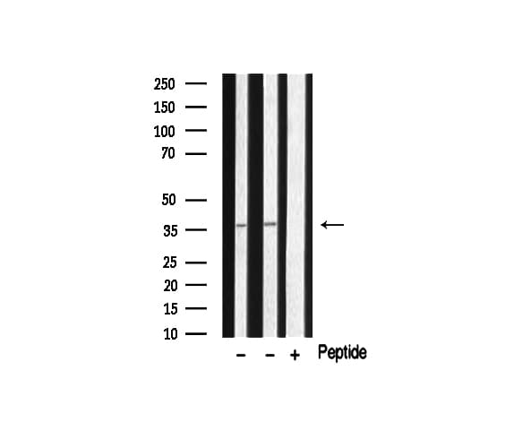 HTR5A / 5-HT5A Receptor Antibody