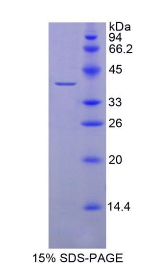 Human BDNF Protein (Recombinant GST)
