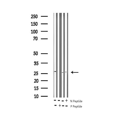 TNNI3 / Cardiac Troponin I Antibody (phospho-Thr142)