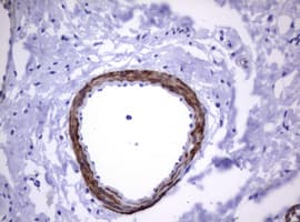 Monoclonal Mouse anti-Human CD30 Antibody (clone OTI9H7, IHC, WB)