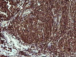 UPRT Antibody (clone OTI2F2)