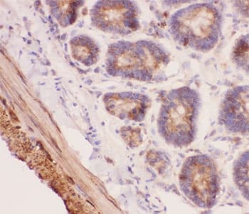 ANG2 / Angiogenin 2 Antibody (aa19-348)