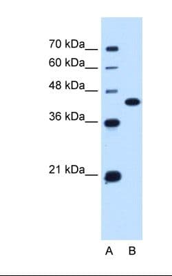 SLC14A1 / JK Antibody (aa119-168)