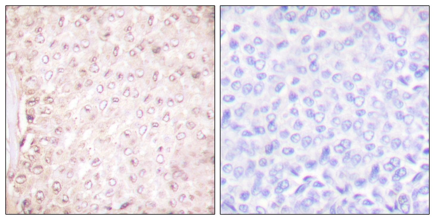 CSTB / Cystatin B / Stefin B Antibody