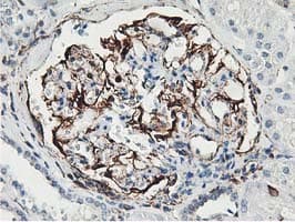 Latexin / MUM Antibody (clone OTI1E10)