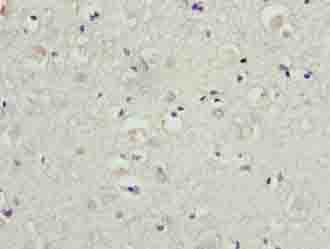 Polyclonal Rabbit anti-Human BATF2 / SARI Antibody (IHC)