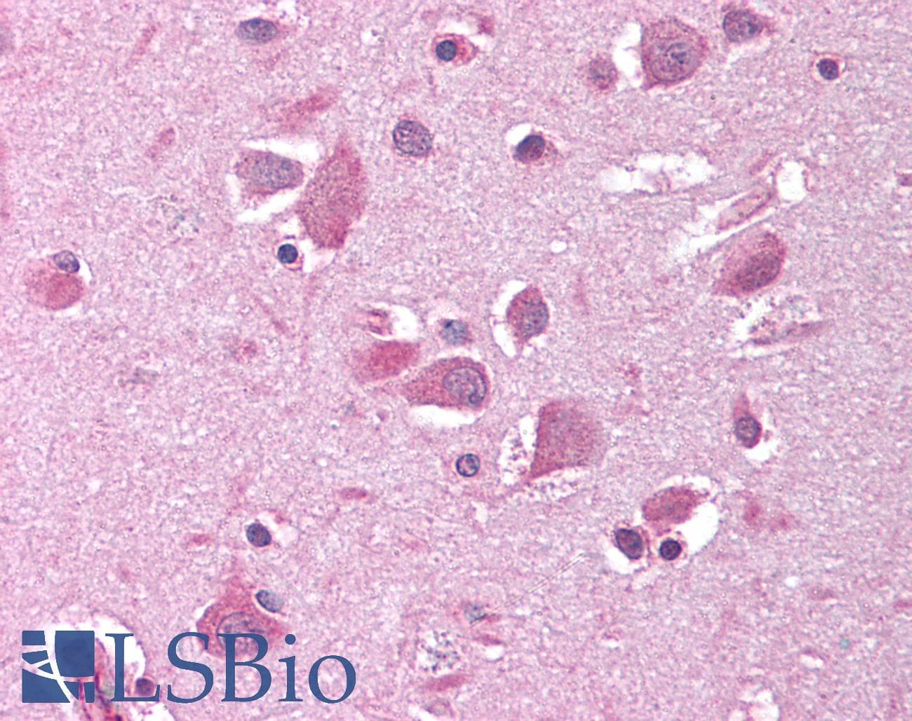 SIRT2 / Sirtuin 2 Antibody (N-Terminus)