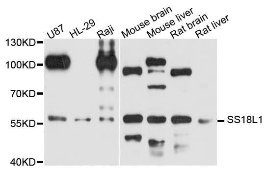 Polyclonal Rabbit anti-Human SS18L1 / CREST Antibody (WB)