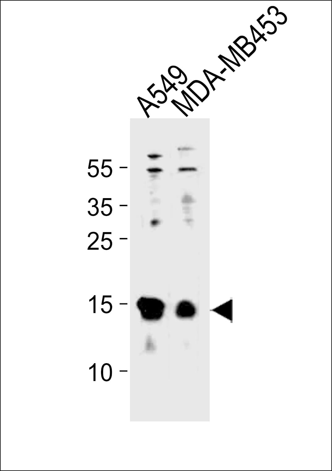 TXN / Thioredoxin / TRX Antibody (aa66-94)