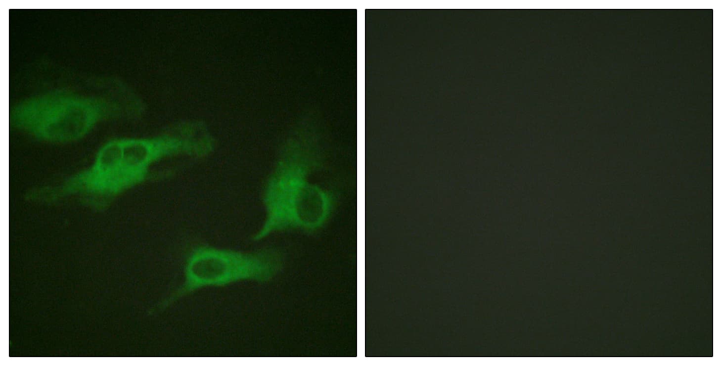 ADRB2 Antibody (phospho-Ser346)