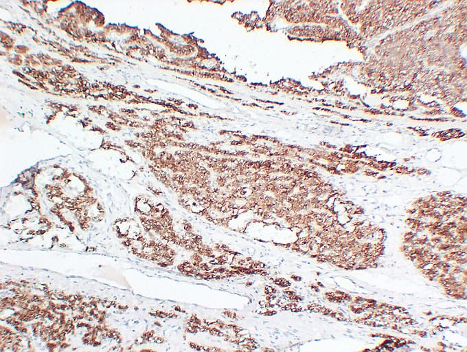 PTH / Parathyroid Hormone Antibody (clone ABT-PTH)