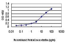 IHC-plus™ MAPK13 / p38delta Antibody (clone 1E11)