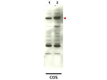 Polyclonal Rabbit anti-Human SMAD4 Antibody (WB)