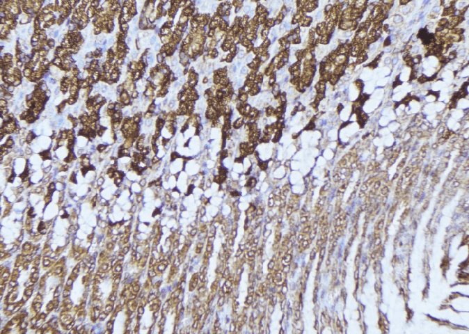 HADHA Antibody