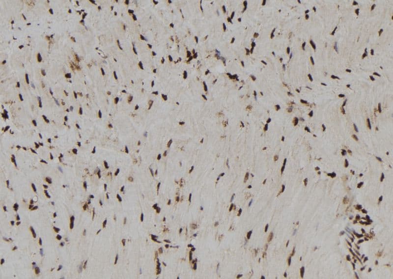 RNH1 Antibody