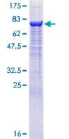 Human AK8 Protein (Recombinant GST)