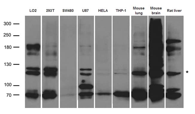 ABCB1 / MDR1 / P Glycoprotein Antibody