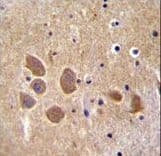 AP1M1 Antibody (aa199-227)