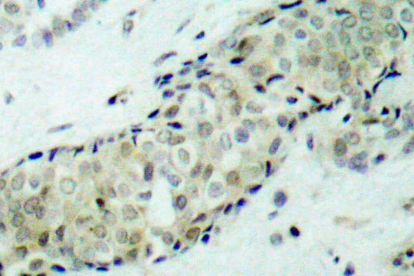 Polyclonal Rabbit anti-Human HDAC5 Antibody (Pro492, IHC, IF, WB)