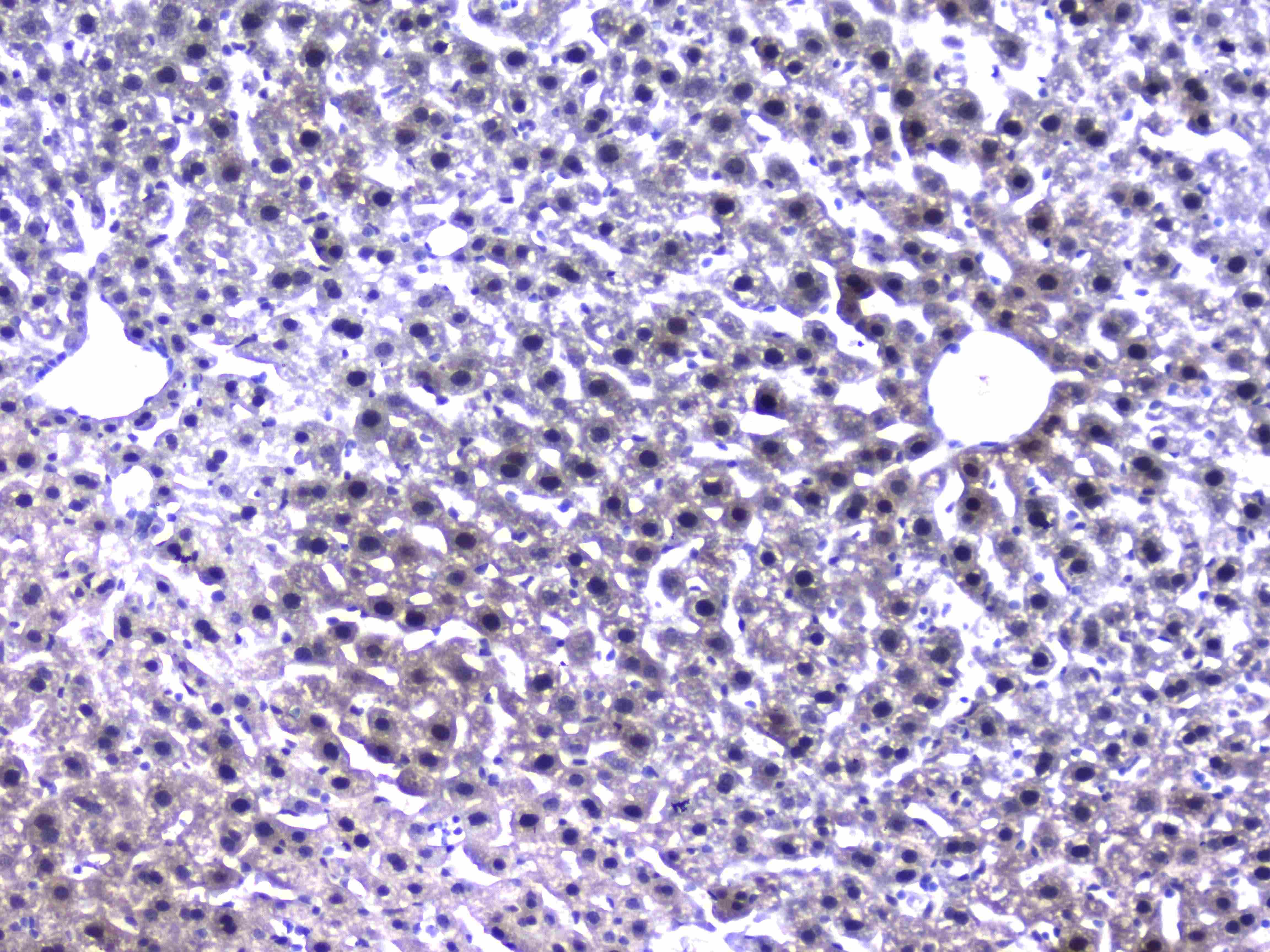 Polyclonal Rabbit anti-Human RXTA / RXR-Alpha Antibody (IHC, WB)