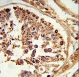 LIPE / HSL Antibody (aa822-849)